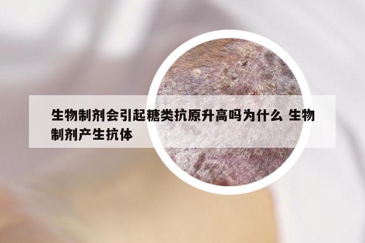 生物制剂会引起糖类抗原升高吗为什么 生物制剂产生抗体