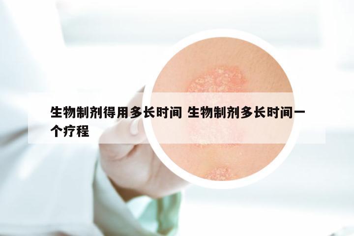 生物制剂得用多长时间 生物制剂多长时间一个疗程