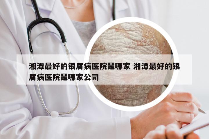 湘潭最好的银屑病医院是哪家 湘潭最好的银屑病医院是哪家公司