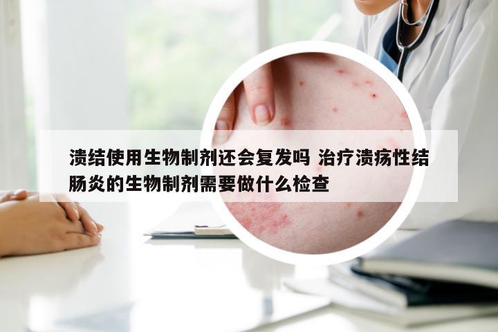 溃结使用生物制剂还会复发吗 治疗溃疡性结肠炎的生物制剂需要做什么检查