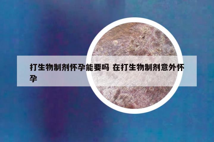 打生物制剂怀孕能要吗 在打生物制剂意外怀孕