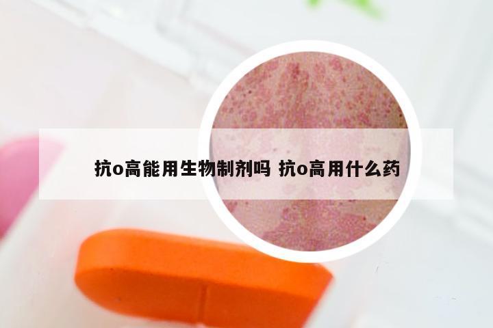 抗o高能用生物制剂吗 抗o高用什么药