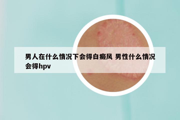 男人在什么情况下会得白癜风 男性什么情况会得hpv