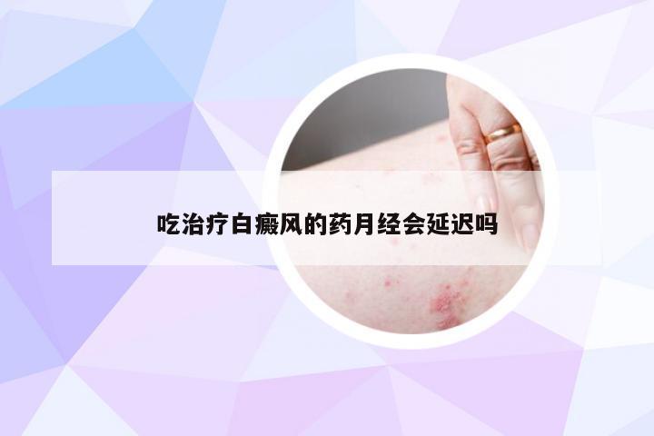 吃治疗白癜风的药月经会延迟吗