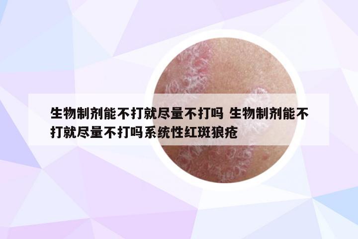 生物制剂能不打就尽量不打吗 生物制剂能不打就尽量不打吗系统性红斑狼疮