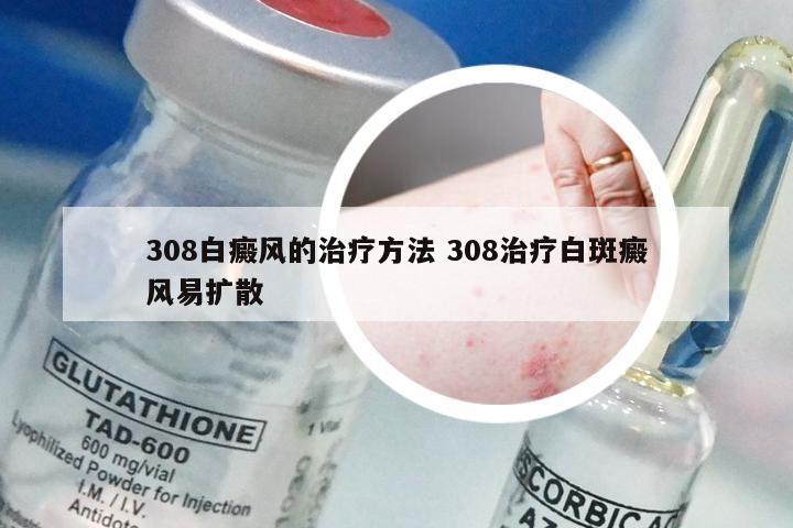 308白癜风的治疗方法 308治疗白斑癜风易扩散