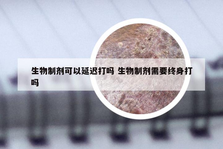 生物制剂可以延迟打吗 生物制剂需要终身打吗