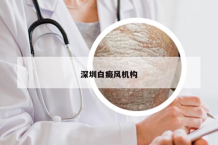 深圳白癜风机构