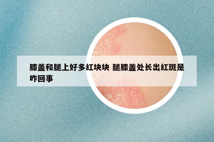 膝盖和腿上好多红块块 腿膝盖处长出红斑是咋回事