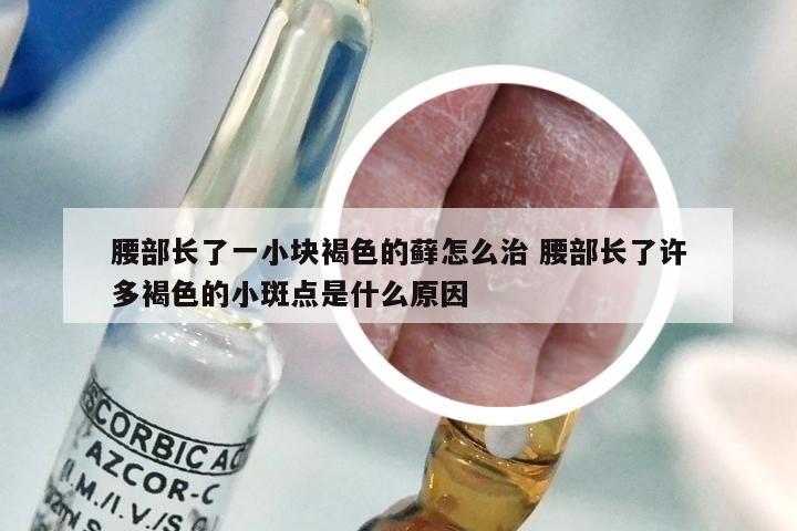 腰部长了一小块褐色的藓怎么治 腰部长了许多褐色的小斑点是什么原因