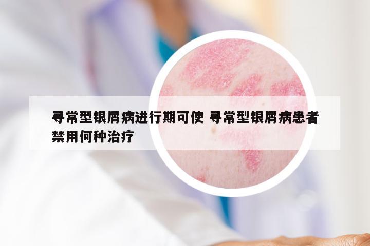 寻常型银屑病进行期可使 寻常型银屑病患者禁用何种治疗