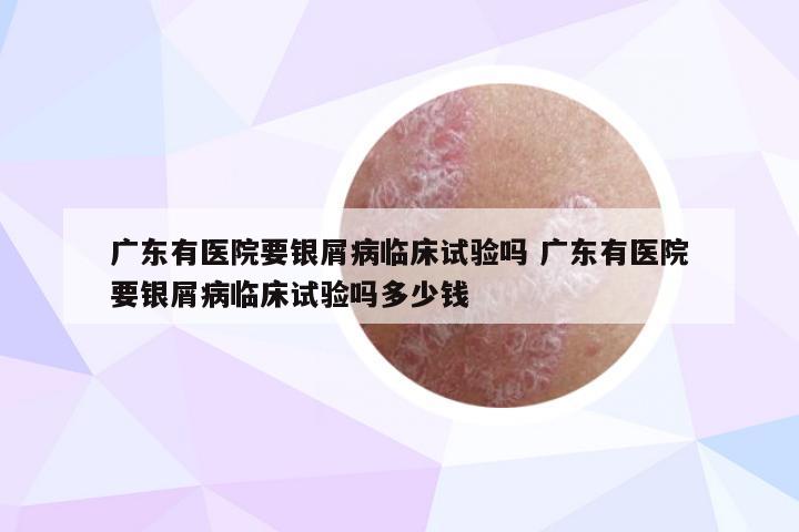 广东有医院要银屑病临床试验吗 广东有医院要银屑病临床试验吗多少钱