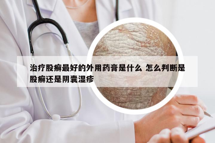 治疗股癣最好的外用药膏是什么 怎么判断是股癣还是阴囊湿疹