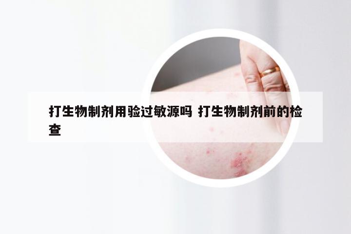 打生物制剂用验过敏源吗 打生物制剂前的检查