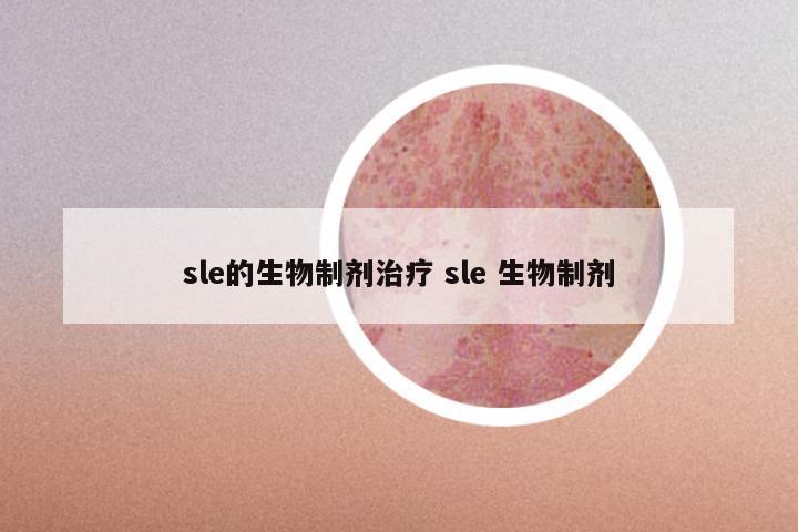 sle的生物制剂治疗 sle 生物制剂