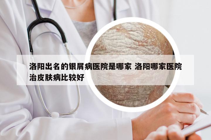 洛阳出名的银屑病医院是哪家 洛阳哪家医院治皮肤病比较好