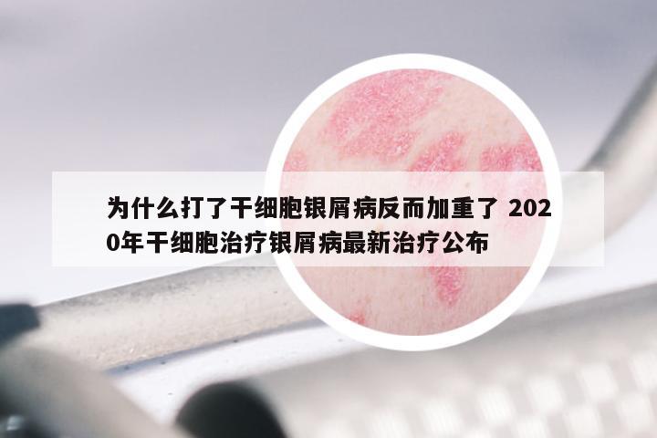 为什么打了干细胞银屑病反而加重了 2020年干细胞治疗银屑病最新治疗公布