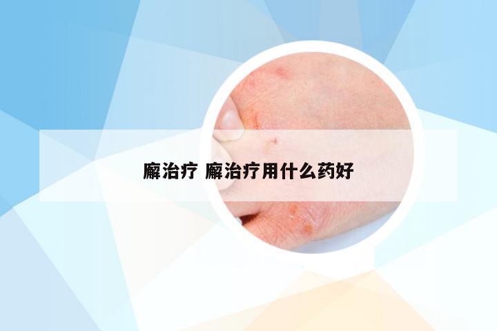 廨治疗 廨治疗用什么药好