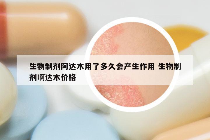 生物制剂阿达木用了多久会产生作用 生物制剂啊达木价格