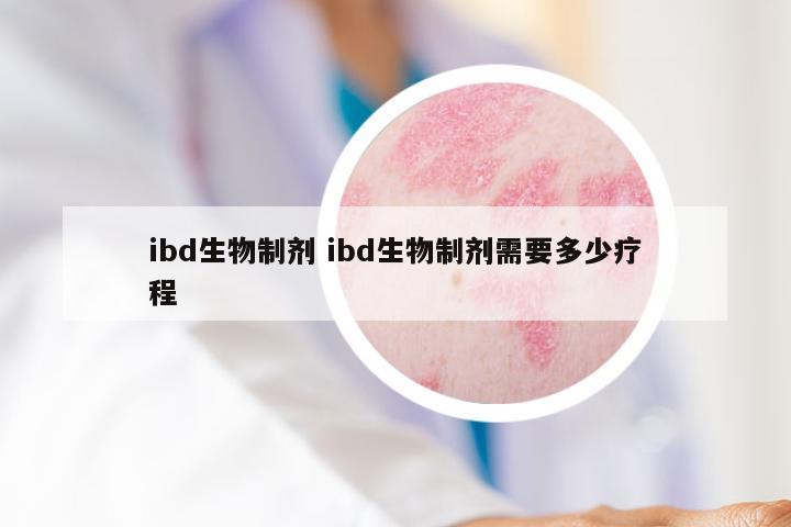 ibd生物制剂 ibd生物制剂需要多少疗程