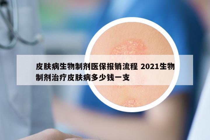 皮肤病生物制剂医保报销流程 2021生物制剂治疗皮肤病多少钱一支