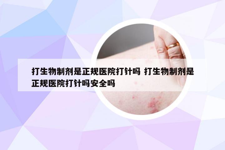 打生物制剂是正规医院打针吗 打生物制剂是正规医院打针吗安全吗