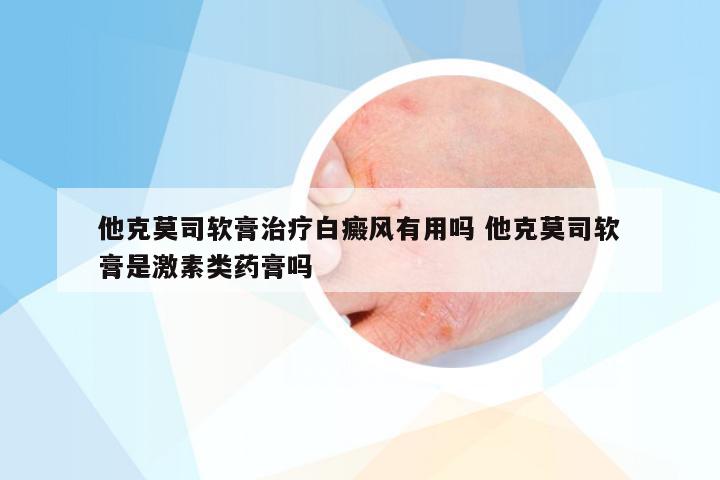 他克莫司软膏治疗白癜风有用吗 他克莫司软膏是激素类药膏吗