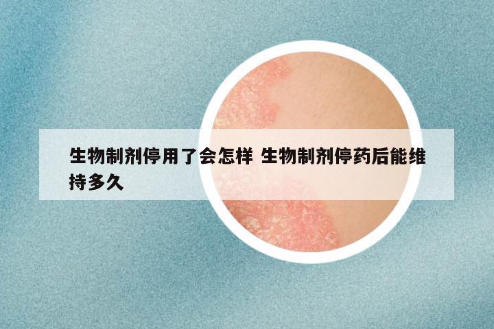 生物制剂停用了会怎样 生物制剂停药后能维持多久