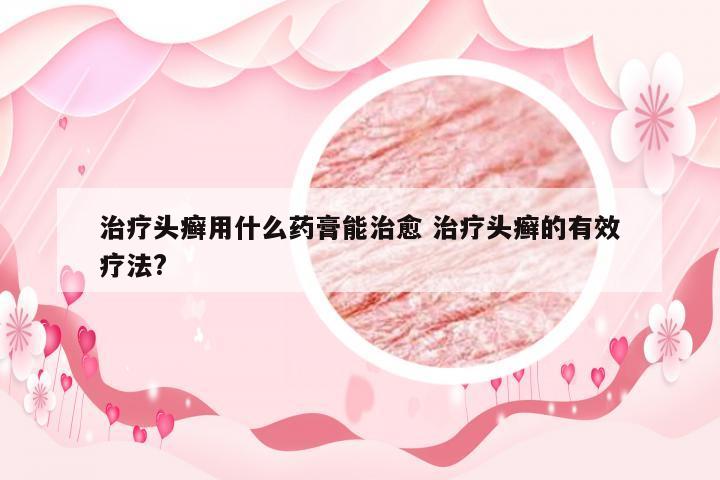 治疗头癣用什么药膏能治愈 治疗头癣的有效疗法?