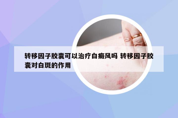 转移因子胶囊可以治疗白癜风吗 转移因子胶囊对白斑的作用