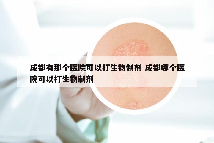 成都有那个医院可以打生物制剂 成都哪个医院可以打生物制剂