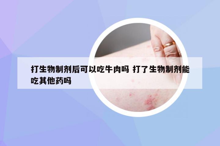 打生物制剂后可以吃牛肉吗 打了生物制剂能吃其他药吗