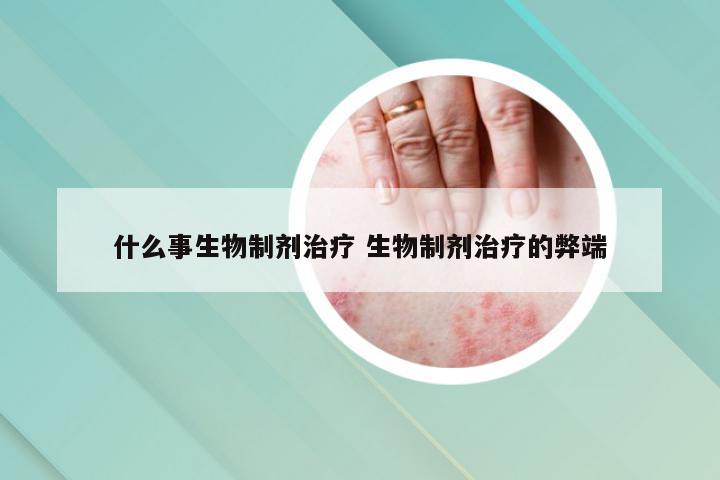 什么事生物制剂治疗 生物制剂治疗的弊端