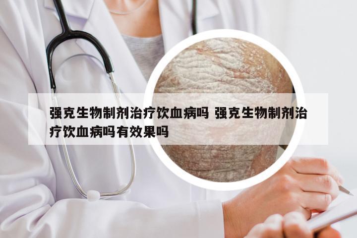 强克生物制剂治疗饮血病吗 强克生物制剂治疗饮血病吗有效果吗