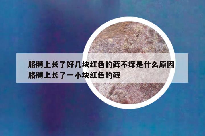 胳膊上长了好几块红色的藓不痒是什么原因 胳膊上长了一小块红色的藓