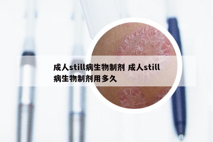 成人still病生物制剂 成人still病生物制剂用多久