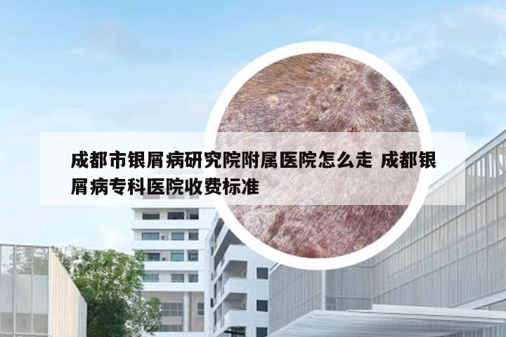 成都市银屑病研究院附属医院怎么走 成都银屑病专科医院收费标准