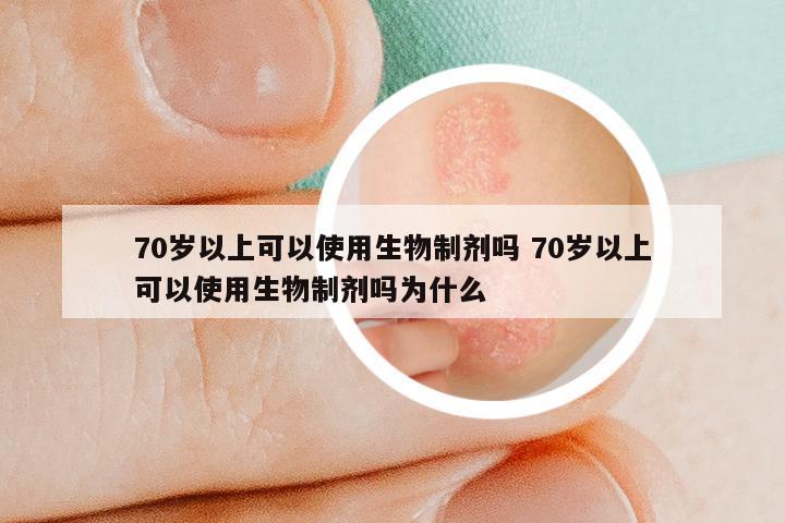 70岁以上可以使用生物制剂吗 70岁以上可以使用生物制剂吗为什么