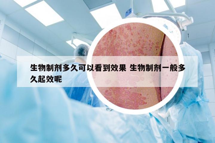 生物制剂多久可以看到效果 生物制剂一般多久起效呢