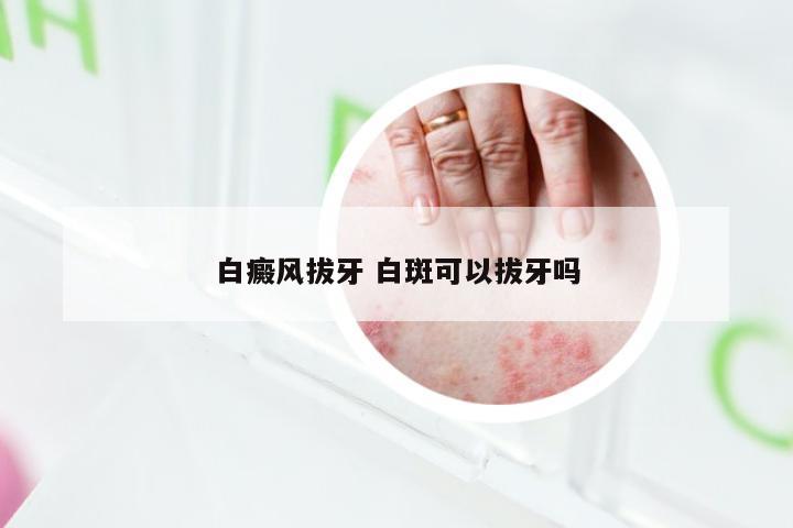 白癜风拔牙 白斑可以拔牙吗