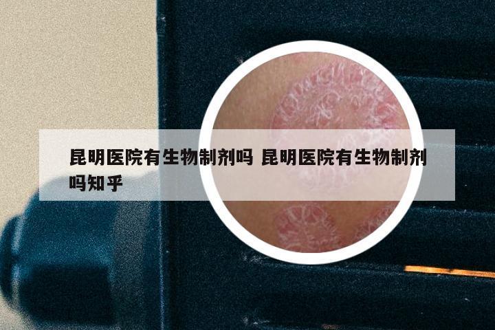 昆明医院有生物制剂吗 昆明医院有生物制剂吗知乎