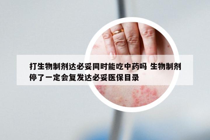 打生物制剂达必妥同时能吃中药吗 生物制剂停了一定会复发达必妥医保目录