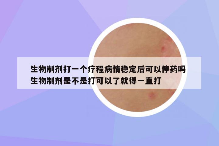 生物制剂打一个疗程病情稳定后可以停药吗 生物制剂是不是打可以了就得一直打