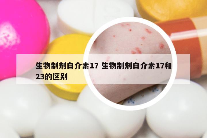 生物制剂白介素17 生物制剂白介素17和23的区别