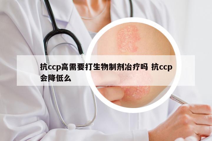 抗ccp高需要打生物制剂冶疗吗 抗ccp会降低么