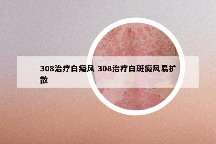 308治疗白癜风 308治疗白斑癜风易扩散