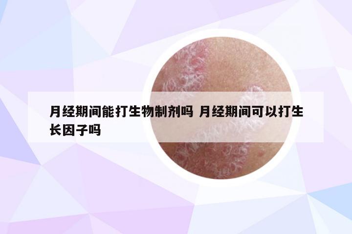 月经期间能打生物制剂吗 月经期间可以打生长因子吗