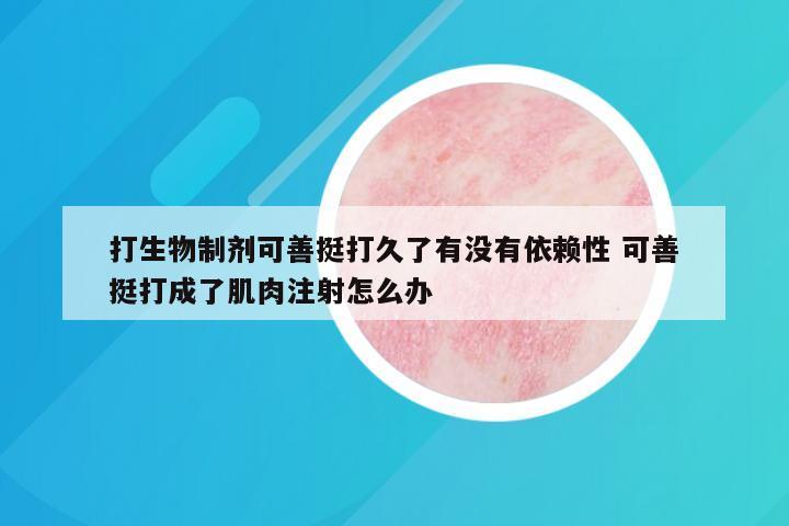 打生物制剂可善挺打久了有没有依赖性 可善挺打成了肌肉注射怎么办