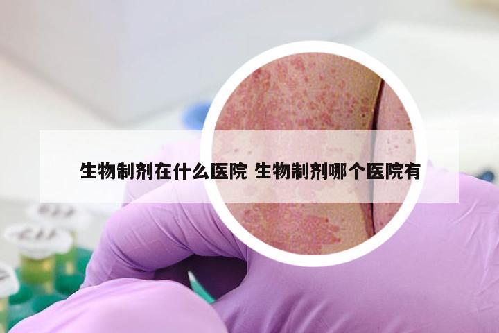 生物制剂在什么医院 生物制剂哪个医院有