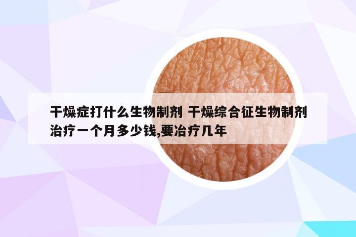 干燥症打什么生物制剂 干燥综合征生物制剂治疗一个月多少钱,要冶疗几年